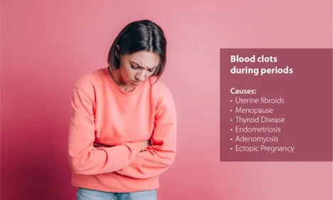 Blood Clots During Periods